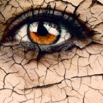 Woman Eye Close Up Dramatic Dry Eye Concept