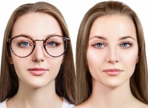 Woman before and after LASIK surgery