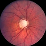 Retina scan
