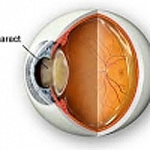 Eye diagram