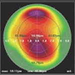 Eye Scan Graphic